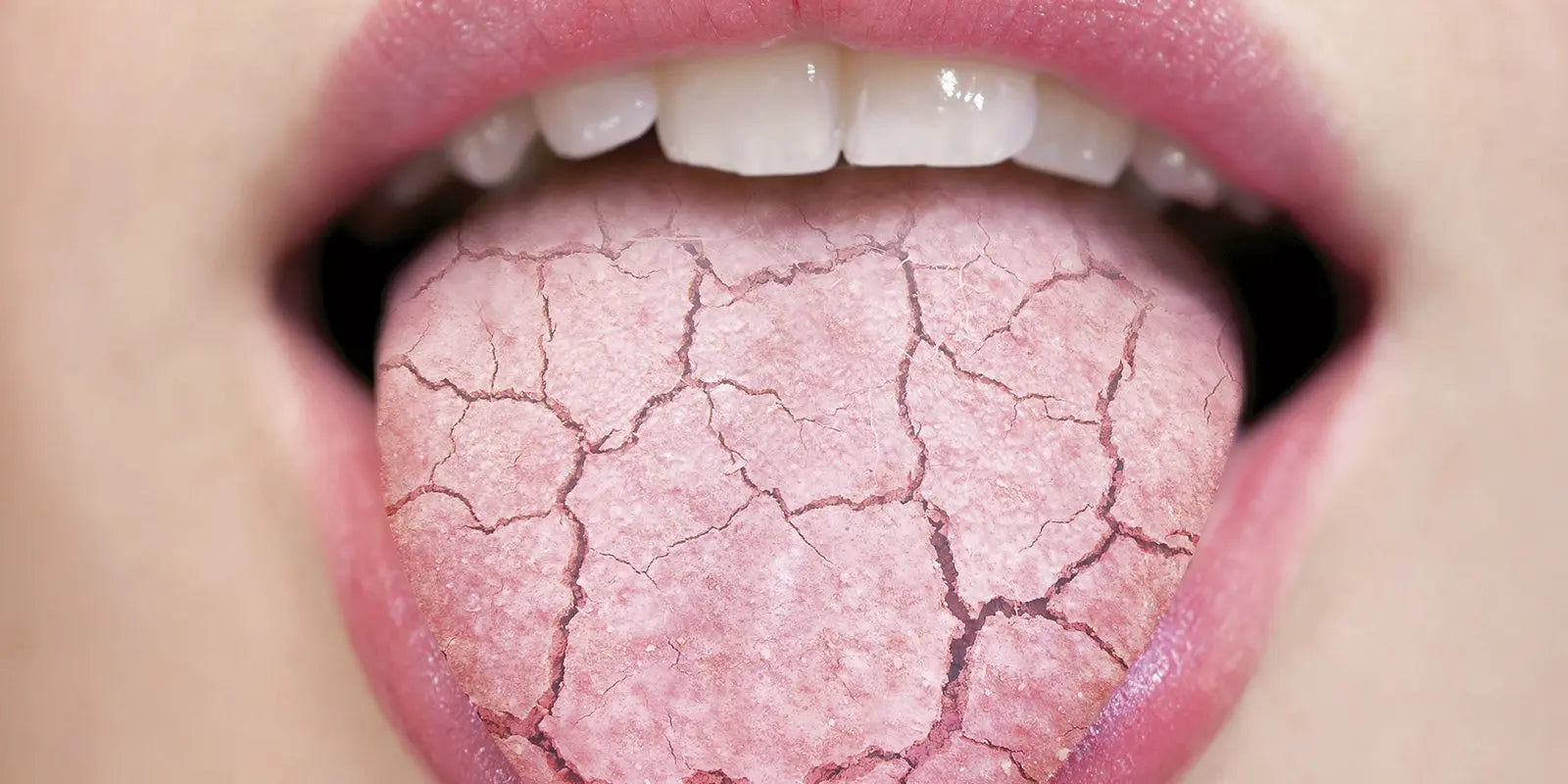 Dealing with Vapers Tongue & Dry Mouth: Tips & Remedies | Selby Vapes selbyvapes Dealing with Vapers Tongue & Dry Mouth: Tips & Remedies | Selby Vapes selbyvapes